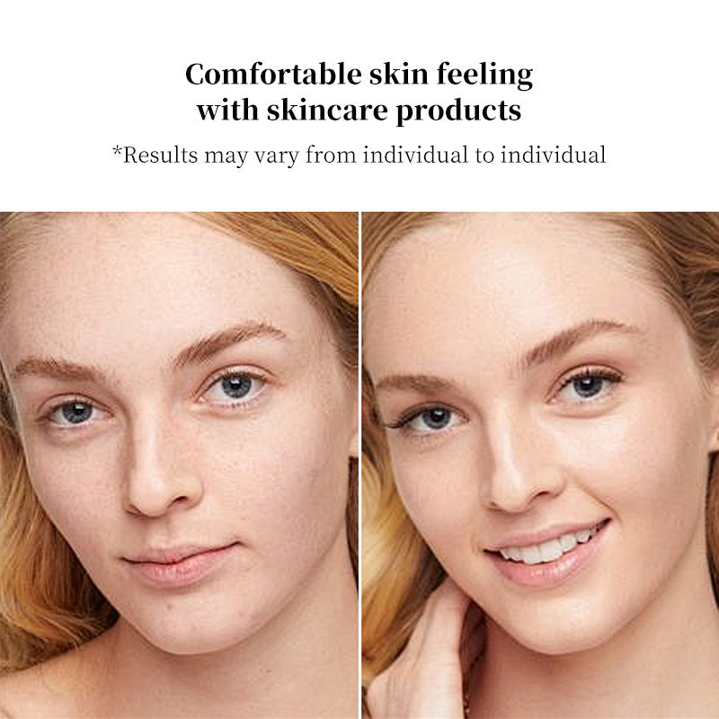 MicroLift Facial Lifting Device