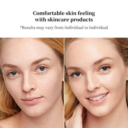 MicroLift Facial Lifting Device